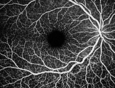 OCT-Aってどこ見てるの？─SDとSSで違う「見える層」