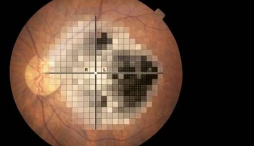 眼科向け｜画像の白→透明に　視野検査結果の画像背景を透明にするツール（β版)